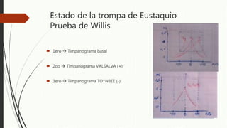 Estado de la trompa de Eustaquio
Prueba de Willis
 1ero  Timpanograma basal
 2do  Timpanograma VALSALVA (+)
 3ero  Timpanograma TOYNBEE (-)
 