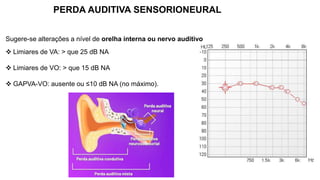 PERDA AUDITIVA SENSORIONEURAL
 Limiares de VA: > que 25 dB NA
 Limiares de VO: > que 15 dB NA
 GAPVA-VO: ausente ou ≤10 dB NA (no máximo).
Sugere-se alterações a nível de orelha interna ou nervo auditivo
 