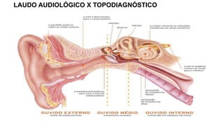 LAUDO AUDIOLÓGICO X TOPODIAGNÓSTICO
 