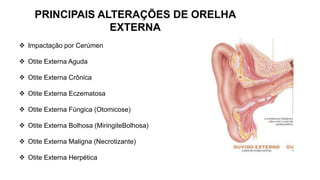  Impactação por Cerúmen
 Otite Externa Aguda
 Otite Externa Crônica
 Otite Externa Eczematosa
 Otite Externa Fúngica (Otomicose)
 Otite Externa Bolhosa (MiringiteBolhosa)
 Otite Externa Maligna (Necrotizante)
 Otite Externa Herpética
PRINCIPAIS ALTERAÇÕES DE ORELHA
EXTERNA
 