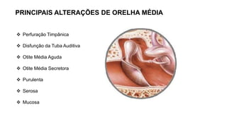  Perfuração Timpânica
 Disfunção da Tuba Auditiva
 Otite Média Aguda
 Otite Média Secretora
 Purulenta
 Serosa
 Mucosa
PRINCIPAIS ALTERAÇÕES DE ORELHA MÉDIA
 