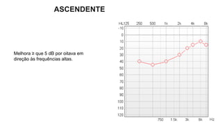 Melhora ≥ que 5 dB por oitava em
direção às frequências altas.
ASCENDENTE
 