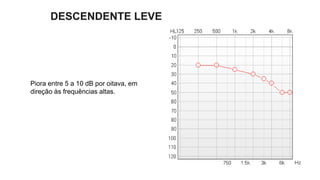 DESCENDENTE LEVE
Piora entre 5 a 10 dB por oitava, em
direção às frequências altas.
 