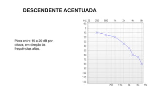 DESCENDENTE ACENTUADA
Piora entre 15 a 20 dB por
oitava, em direção às
frequências altas.
 