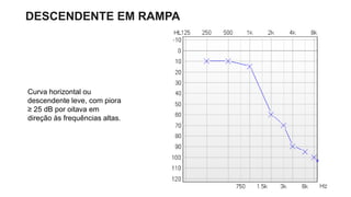 DESCENDENTE EM RAMPA
Curva horizontal ou
descendente leve, com piora
≥ 25 dB por oitava em
direção às frequências altas.
 