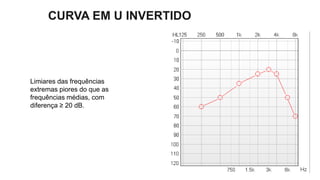 CURVA EM U INVERTIDO
Limiares das frequências
extremas piores do que as
frequências médias, com
diferença ≥ 20 dB.
 