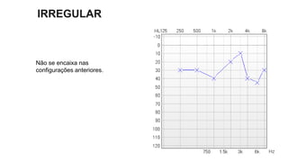 IRREGULAR
Não se encaixa nas
configurações anteriores.
 