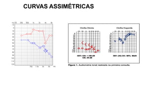 CURVAS ASSIMÉTRICAS
 