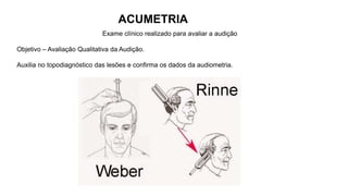 ACUMETRIA
Exame clínico realizado para avaliar a audição
Objetivo – Avaliação Qualitativa da Audição.
Auxilia no topodiagnóstico das lesões e confirma os dados da audiometria.
 
