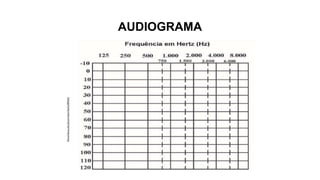 AUDIOGRAMA
 