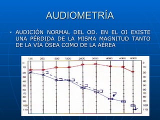 AUDIOMETRÍA
   AUDICIÓN NORMAL DEL OD. EN EL OI EXISTE
    UNA PÉRDIDA DE LA MISMA MAGNITUD TANTO
    DE LA VÍA ÓSEA COMO DE LA AÉREA
 