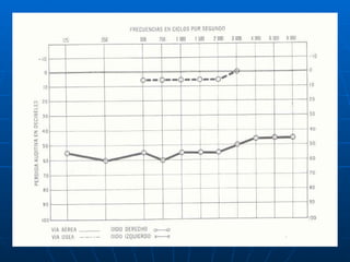 Audiologia y estudios audiometricos