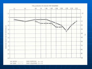 Audiologia y estudios audiometricos