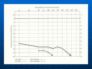 Audiologia y estudios audiometricos