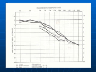 Audiologia y estudios audiometricos
