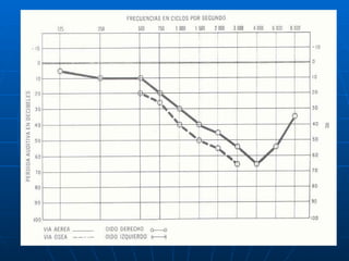 Audiologia y estudios audiometricos