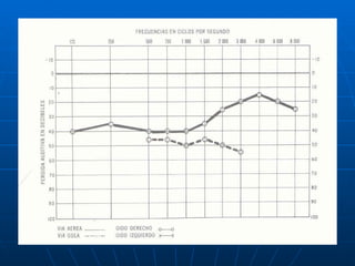 Audiologia y estudios audiometricos