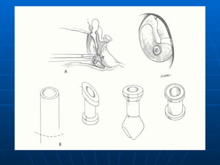 Audiologia y estudios audiometricos