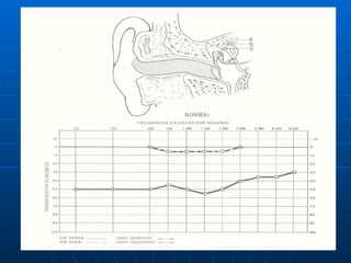 Audiologia y estudios audiometricos