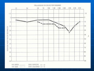Audiologia y estudios audiometricos