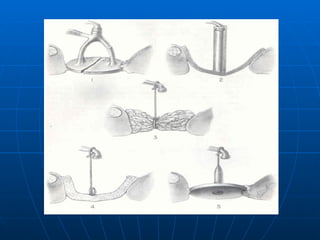 Audiologia y estudios audiometricos