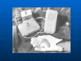 Audiologia y estudios audiometricos