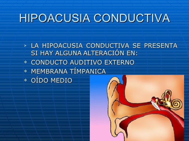 Audiologia y estudios audiometricos