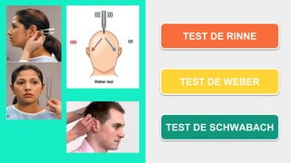 TEST DE RINNE
TEST DE WEBER
TEST DE SCHWABACH
 