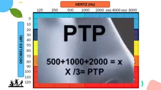 HERTZ (Hz)
DECIBELES
(dB)
 