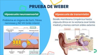 Escajadillo, J., R. (2009) Oidos, nariz, garganta y cirugía cabeza y cuello. 4a. edición.méxico. Editorial. El Manual
Moderno. S.A. de C.V. ISBN 978-607-448-414-4, ISBN 978-607-448-413-7 (Versión Electrónica) .
Hipoacusia de transmisión
Hipoacusia neurosensorial
Problema en órgano de Corti, fibras
nerviosas y NC VIII (oído intero)
Desde membrana timpánica hasta
cápsula ótica en la ventana oval (oído
medio) y menos común oídos externo
PRUEBA DE WEBER
 