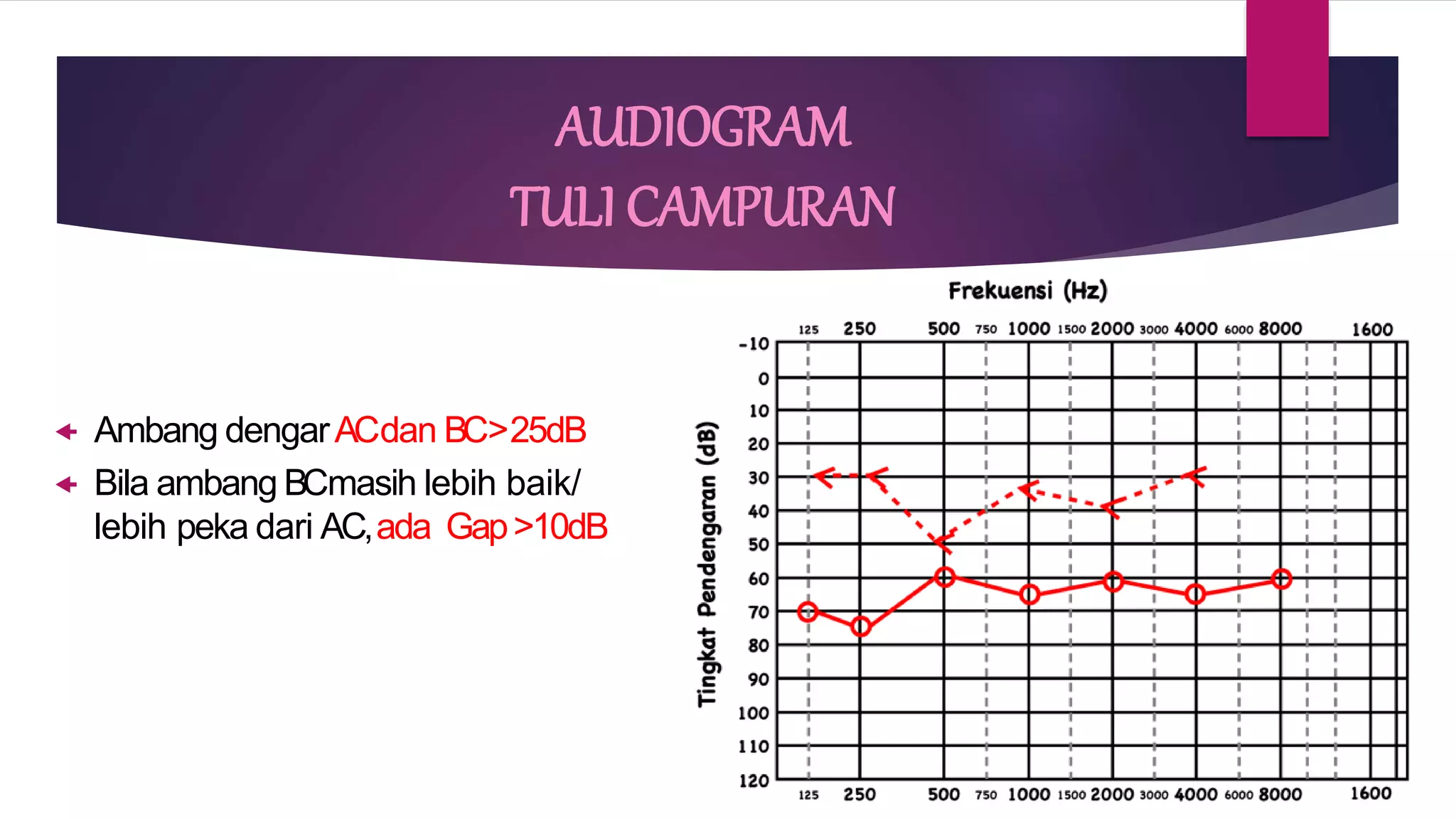 AUDIOMETRI Dr Shanti Puji Lestari Sp Ok pptx AUDIOMETRI Dr Shanti Puji Lestari Sp Ok pptx