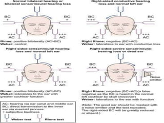 Audiometry | PPTX