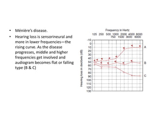 Audiometry | PPT