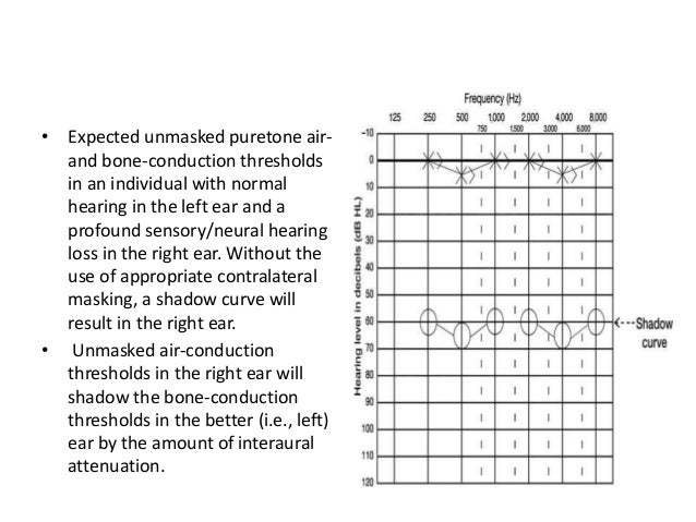 Audiometry
