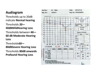 Audiometry | PPTX