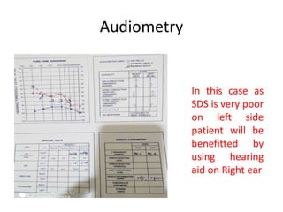 Audiometry | PPTX