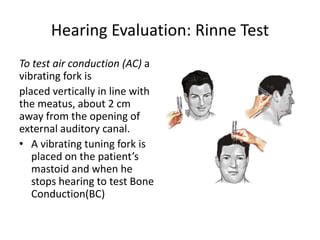 Tes Rinne Audiometry | PPTX