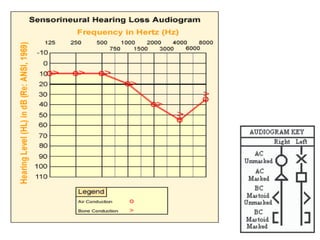 Human Physiology of audiometry and principles (3).pptx