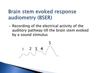  Recording of the electrical activity of the
auditory pathway till the brain stem evoked
by a sound stimulus
1 2 3 4
5
 