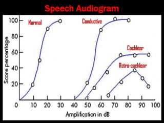Audiometry for Undergraduate and postgraduate ENT students | PPT