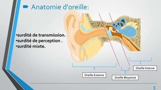  Anatomie d'oreille:
Oreille Externe
Oreille Interne
Oreille Moyenne
•surdité de transmission.
•surdité de perception .
•surdité mixte.
5
 