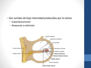 • Son sonidos de baja intensidad producidos por la cóclea
• Espontáneamente
• Respuesta a estímulos
 