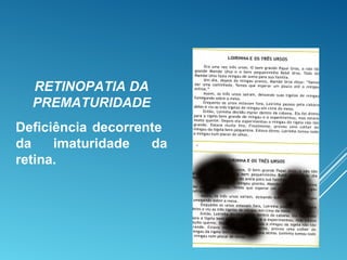 RETINOPATIA DA
PREMATURIDADE
Deficiência decorrente
da imaturidade da
retina.
 