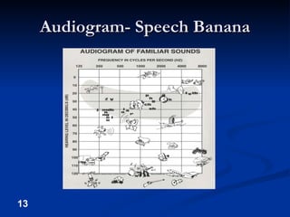 Audiogram- Speech Banana 