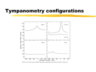 Tympanometry configurations 