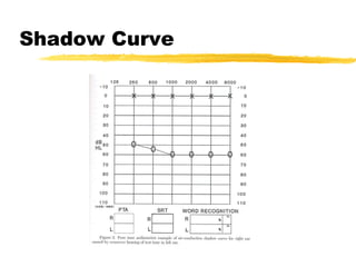 Shadow Curve 