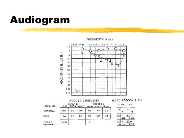 Auditory assess 200003