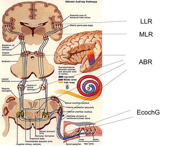 Auditory Brainstem Response ghfghhfrh.pptx