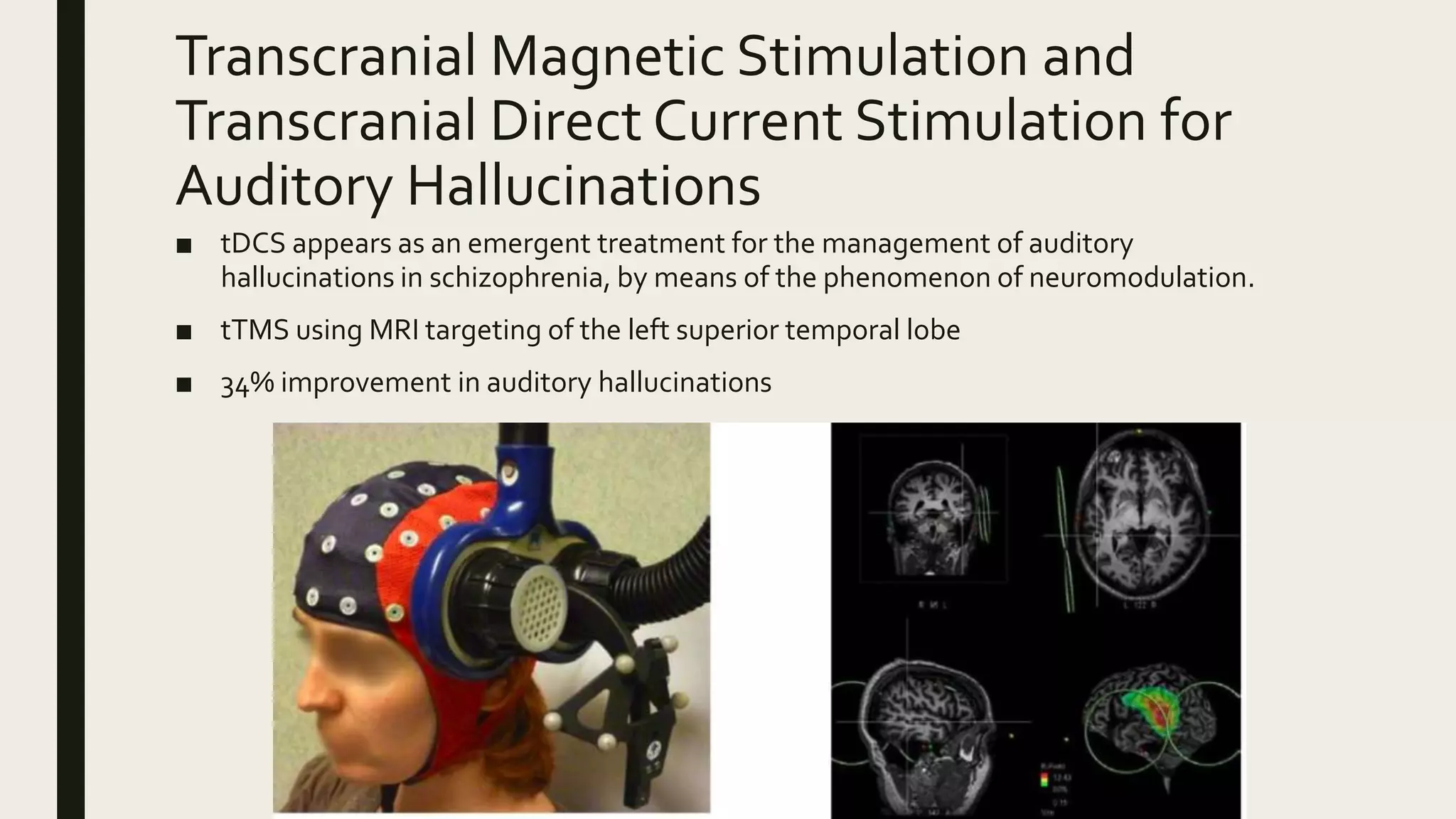 Transcranial Magnetic Stimulation and
Transcranial Direct Current Stimulation for
Auditory Hallucinations
■ tDCS appears as an emergent treatment for the management of auditory
hallucinations in schizophrenia, by means of the phenomenon of neuromodulation.
■ tTMS using MRI targeting of the left superior temporal lobe
■ 34% improvement in auditory hallucinations
 