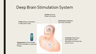 Probe Delivers stimulation
to deep brain nuclei
Anchor Secures
Probe to the skull
Connector Establishes
link to the Controller
Programmer Communicates
with the Controller to customize
therapy
Controller Determines
parameters for brain
stimulation and houses the
power source
Deep Brain Stimulation System
 